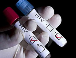 HIV1.jpg
