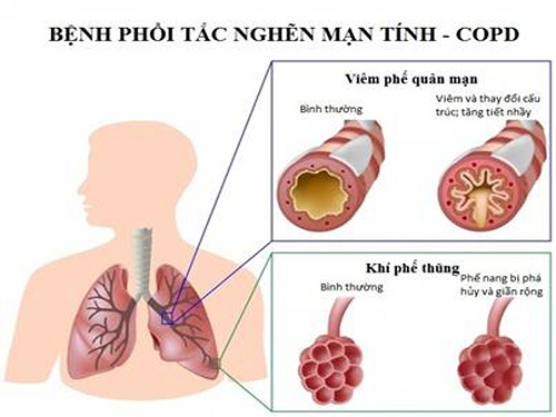 phoi tac ngen.jpg