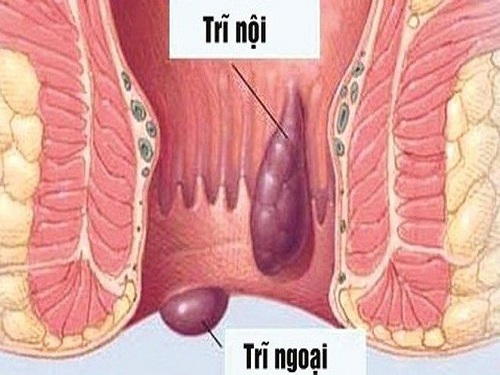 trỉ.jpg