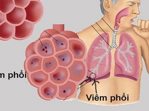 Viemphoi1.jpg